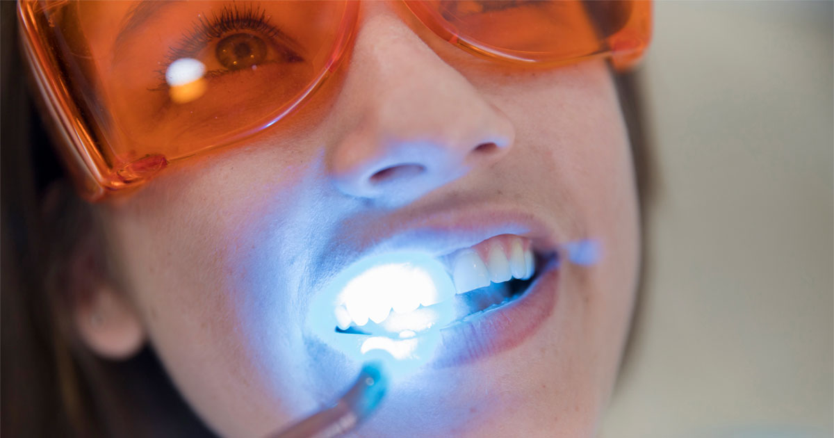 Cosmetic Dentistry | DentPhix Clinics