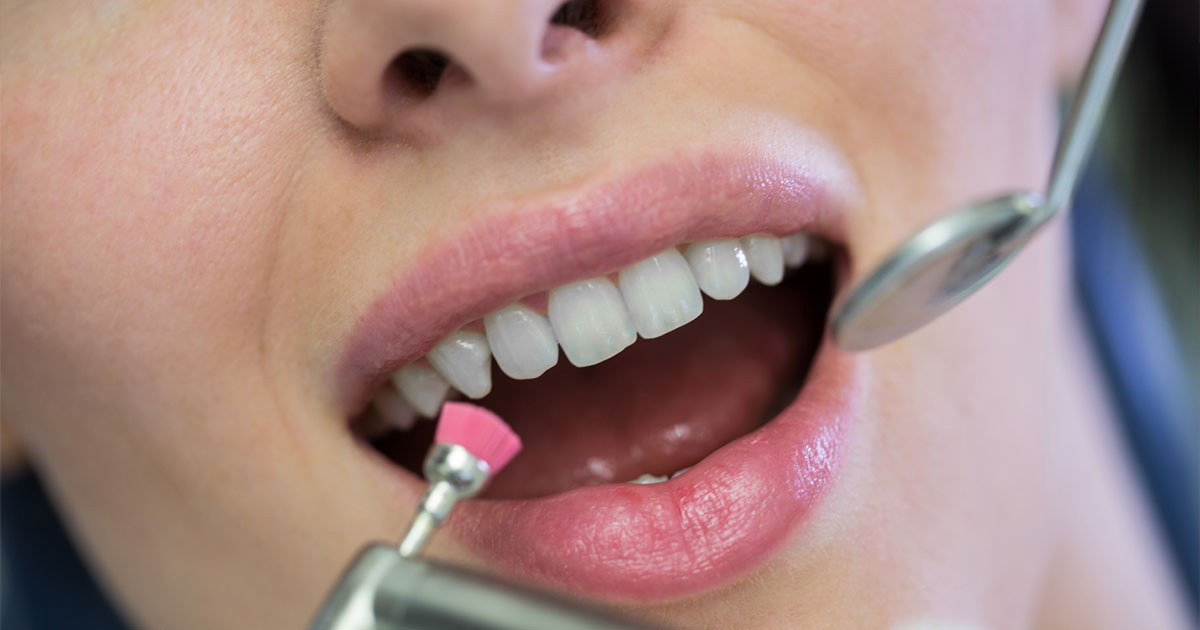 General Dentistry | DentPhix Clinics